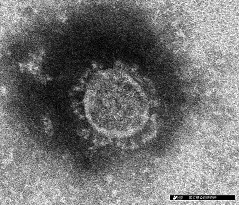 【新型コロナウイルス感染症】 新たな検査法の開発が急ピッチで進む　検出時間を大幅短縮　今月中にも実用化か