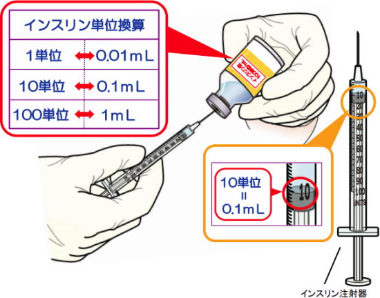 インスリンポンプ