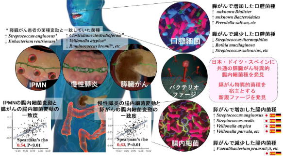 すい臓がんは遺伝するのでしょうか？