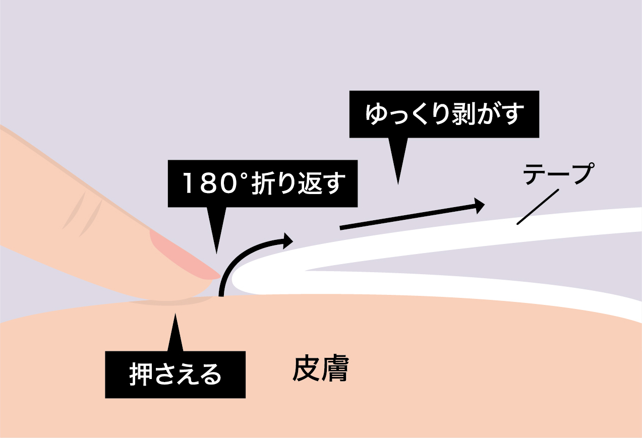 剥がし方のポイント