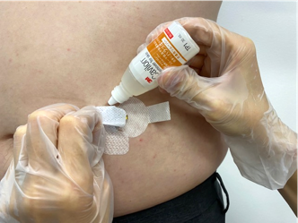 写真6：剥離剤を使う場合